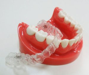 歯科医師あるある【歯科矯正の加算と実務】|歯科専門の人材派遣　u2株式会社